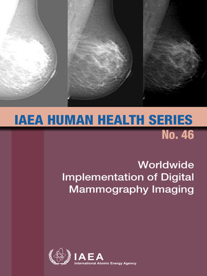 cover image of Worldwide Implementation of Digital Mammography Imaging